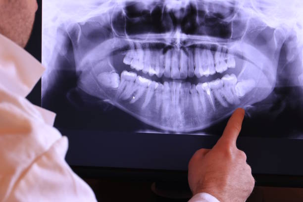 Urgent Tooth Repair in CA